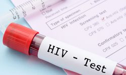 Türkiye'nin AIDS raporu açıklandı!